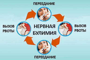 Лечение булимии в Яранске